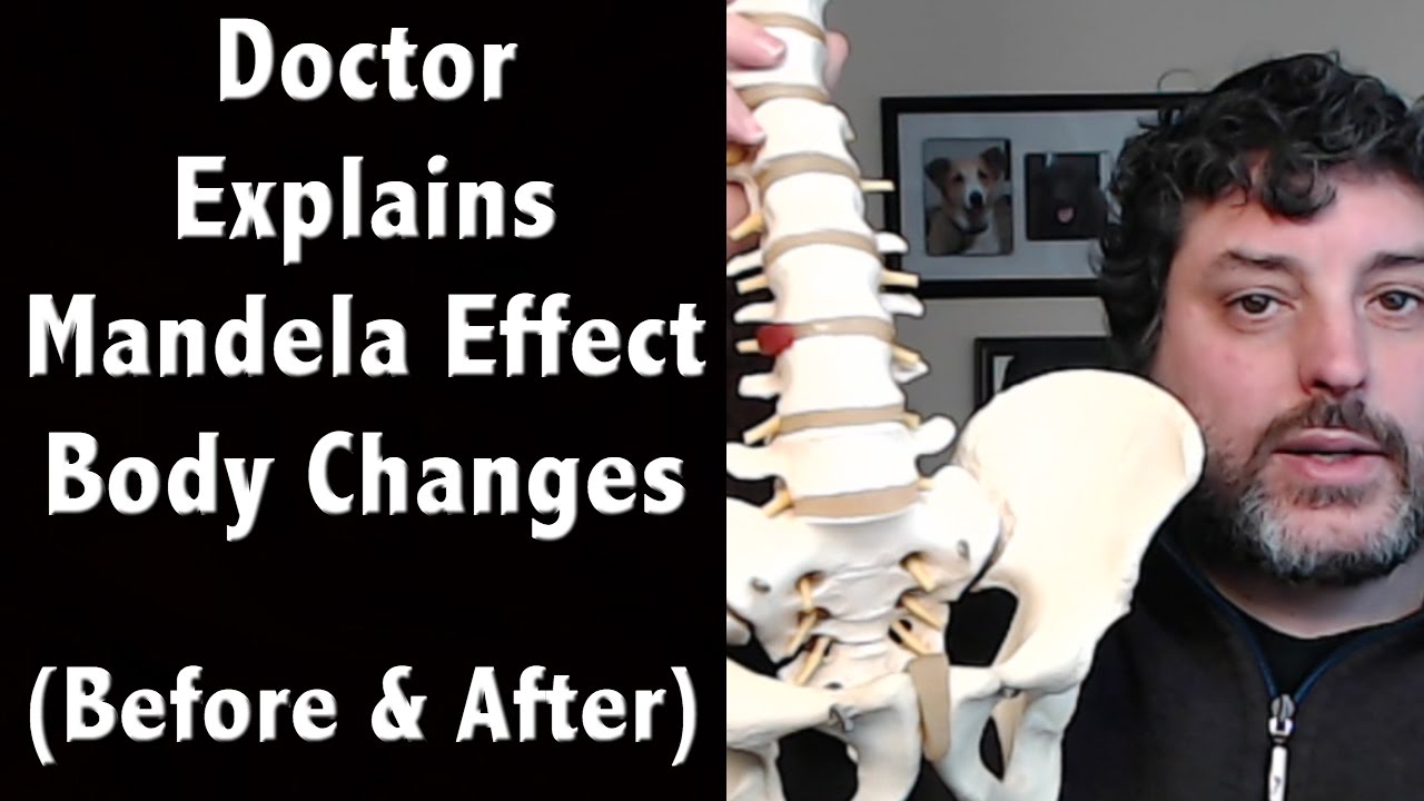 Doctor Explains Mandela Effect Body Changes – Compares Body Then to Now